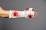 Krperteile blutiger Handverband